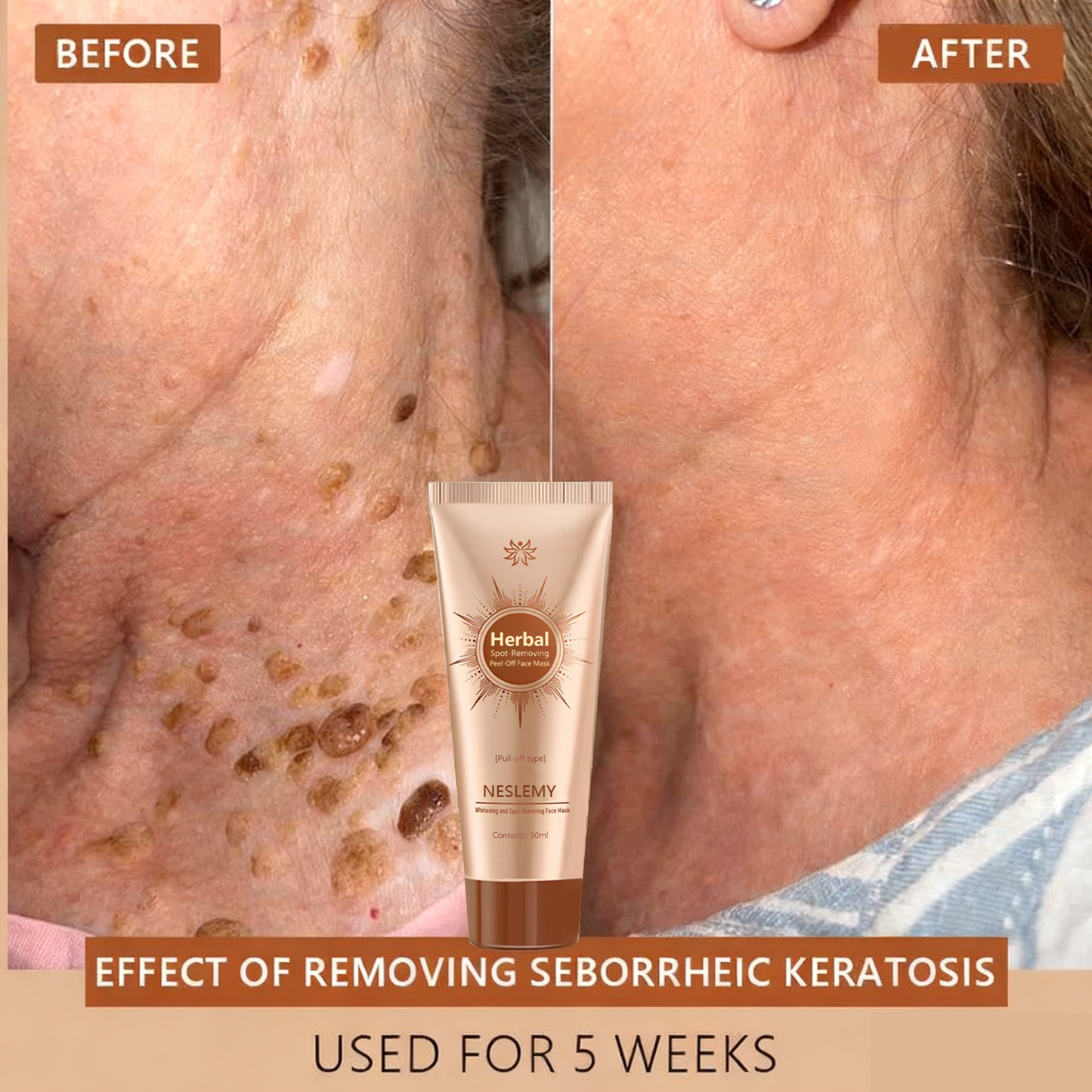 🏵️ NESLEMY™ Whitening and Spot-Removing Face Mask Suitable for face and body