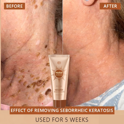 🏵️ NESLEMY™ Whitening and Spot-Removing Face Mask Suitable for face and body