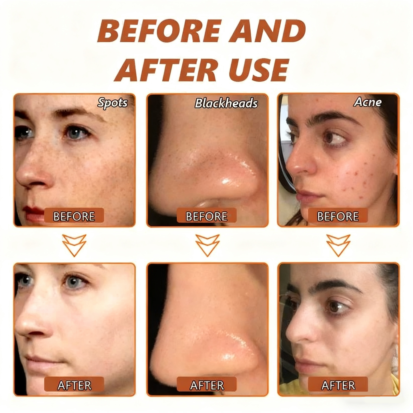 🏵️ NESLEMY™ Whitening and Spot-Removing Face Mask Suitable for face and body