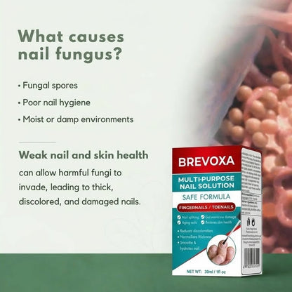 Nail Fungus Treatment Gel | Visibly Restores Damaged Nails and Helps Combat Fungi in Just Days