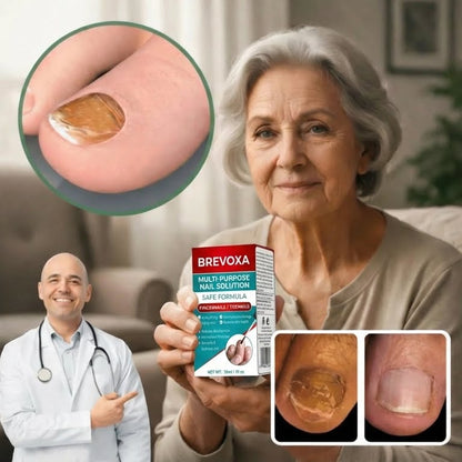 Nail Fungus Treatment Gel | Visibly Restores Damaged Nails and Helps Combat Fungi in Just Days