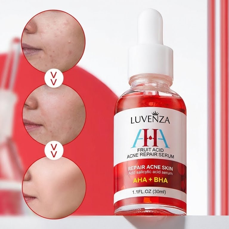 👏🌟LUVENZA® Acid Acne Treatment Essence: Skin-nourishing, moisturizing, and fades acne scars and pimples